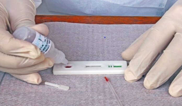 teste-covid-capa-730x425